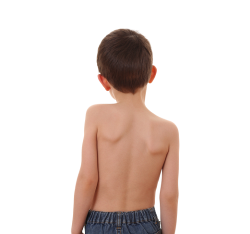 신경 근육성 질환